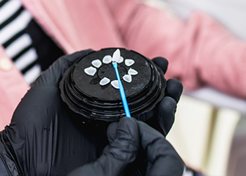 Cosmetic dentist holding a Lumineer with a thin dental instrument