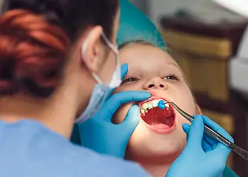 Young girl in dental chair having fluoride applied to her teeth